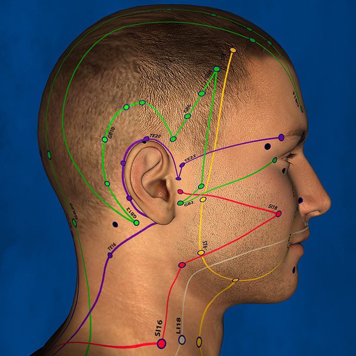 Meniere’s Disease